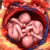 Dr. Javid OB-GYN