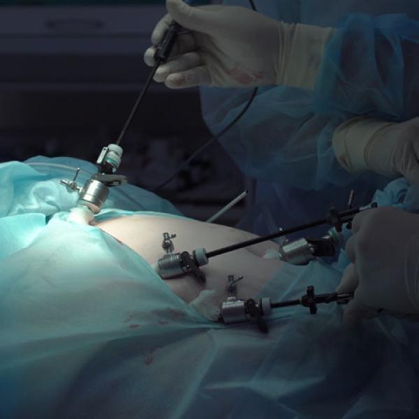 C-Section