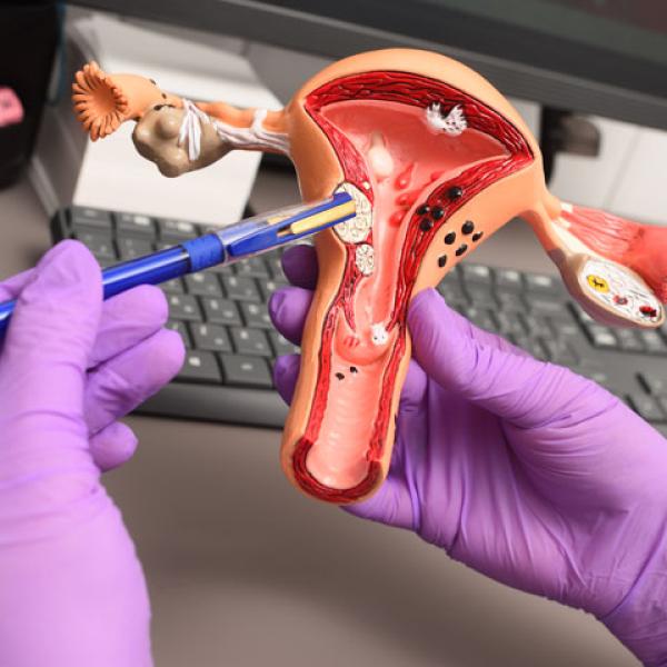 Uterus sample